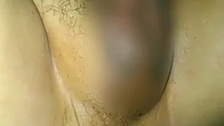 医療プレイでアナルフィスト2016 - FC2 Video - 225386