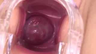 成熟マダムの熟れたおまんこ　オナニーした後オーガズムになった直後の膣内の愛液状態をクスコで観察する - FC2 Video - 252621