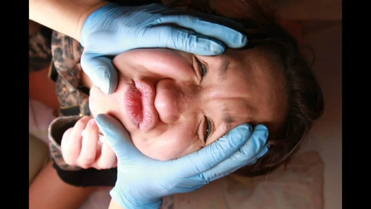 彼氏と電話中にゴム手袋で顔を好きなように変形させられて爆笑モノのタコチュー顔になってしまうギャル! - FC2 Video - 306371