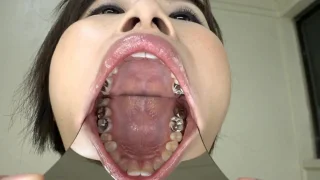 お口も歯もでっかいショートカット女子を口内観察！舌も銀歯もノドチンコも丸見えでヌラヌラしている！ - FC2 Video - 319430