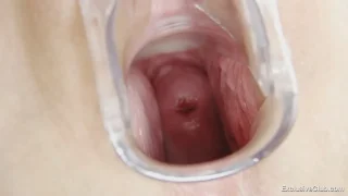 定期健診のクランケ　内部は綺麗なサーモンピンクで膣内洗浄処置だけしておきますと太鼓判を押すドクター - FC2 Video - 321439