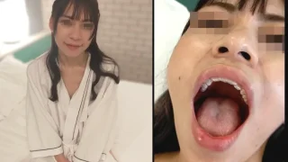 本編顔出し!!【元芸能人のプレミアハーフ美女】しずかちゃんに歯医者変態プレイ!!大口を開けさせ、口腔内を楽しみ、鼻舐め＆口臭を嗅ぎながら、1週間溜めた精子を生ハメ中出し - FC2 Video - 377285