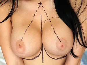 Aletta Gets A Boob Job! - 21Sextury - 12163